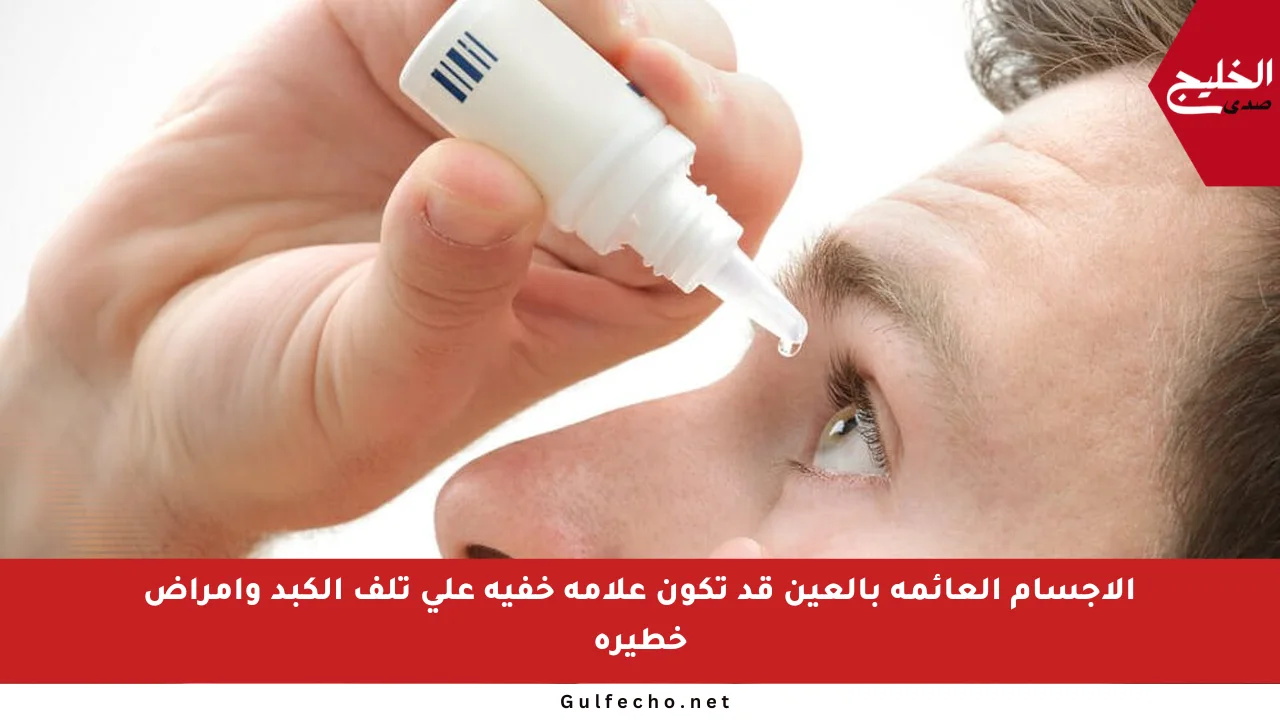 الأجسام العائمة بالعين قد تكون علامة خفية على تلف الكبد وأمراض خطيرة